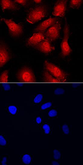 CBFB antibody in HUVEC Human Cells by Immunocytochemistry (ICC).