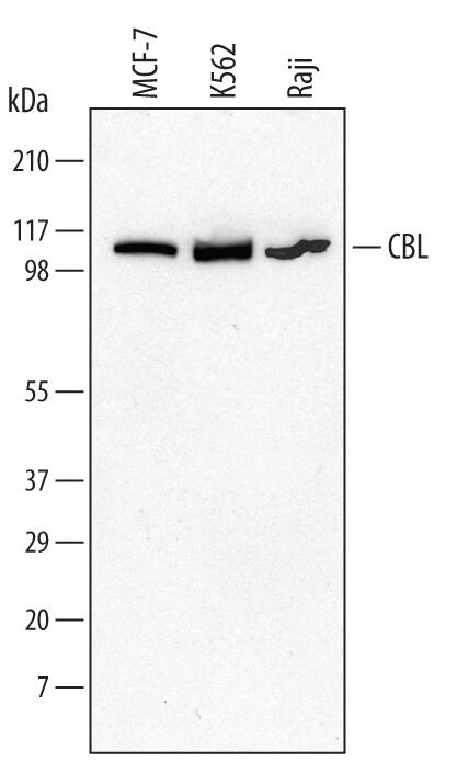 Detection of Human CBL antibody by Western Blot.