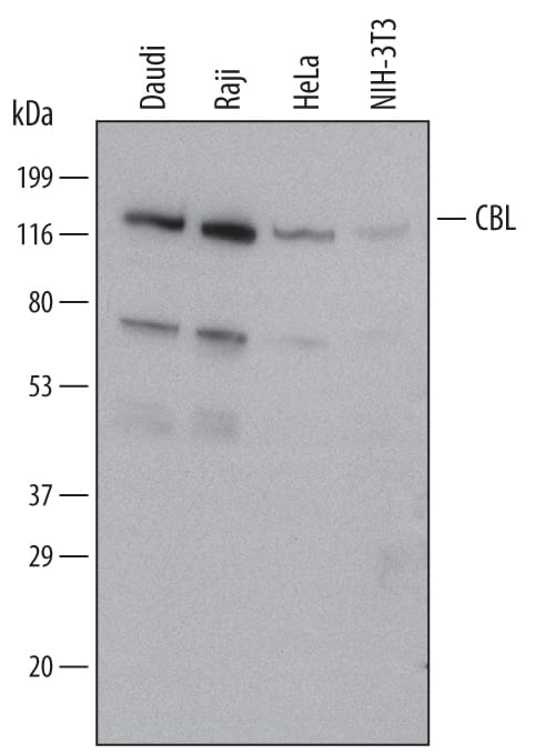 Detection of Human and Mouse CBL antibody by Western Blot.