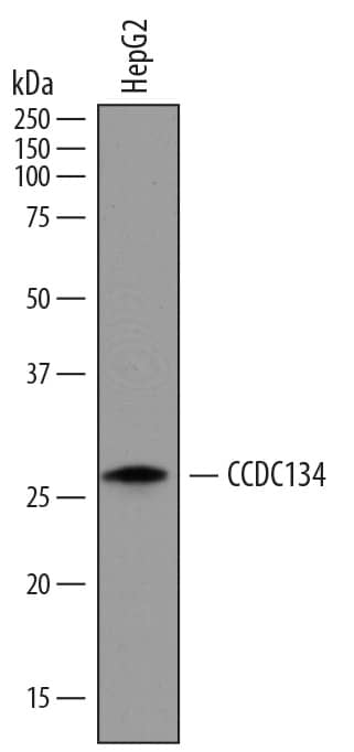 Detection of Human CCDC134 antibody by Western Blot.