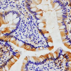 CCL11/Eotaxin antibody in Human Colon by Immunohistochemistry (IHC-P).