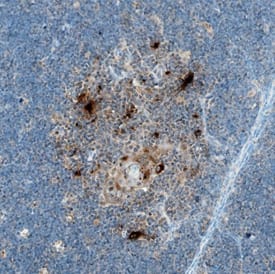 CCL17/TARC antibody in Human Spleen by Immunohistochemistry (IHC-P).