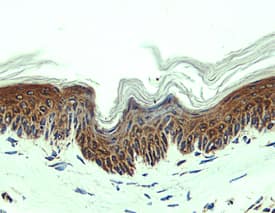 CCL27/CTACK antibody in Mouse Skin by Immunohistochemistry (IHC-Fr).
