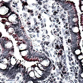 CCL2/JE/MCP-1 antibody in Human Crohn's Disease Intestine by Immunohistochemistry (IHC-P).