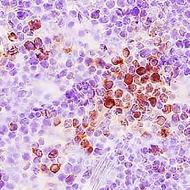 CCL3/MIP-1a antibody in Mouse Thymus by Immunohistochemistry (IHC-Fr).