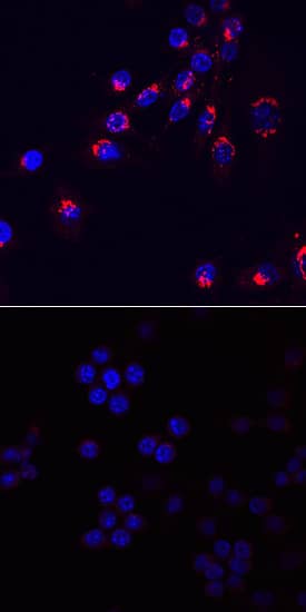 CCL3/MIP-1a antibody in RAW 264 by Immunocytochemistry (ICC).7 Mouse Cell Line by Immunocytochemistry (ICC).
