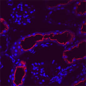 CCL3/MIP-1a antibody in Rat Kidney by Immunohistochemistry (IHC-Fr).