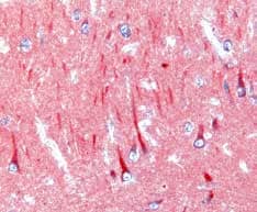 CCL4/MIP-1 beta antibody in Human Alzheimer's Disease Brain by Immunohistochemistry (IHC-P).