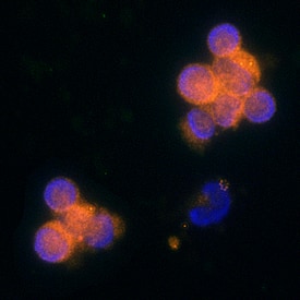 CCL5/RANTES antibody in Human PBMCs by Immunocytochemistry (ICC).