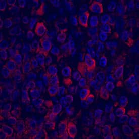 CCL5/RANTES antibody in Human Tonsil by Immunohistochemistry (IHC-P).