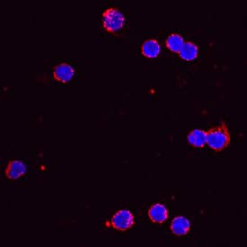 CCL5/RANTES antibody in Mouse Splenocytes by Immunocytochemistry (ICC).