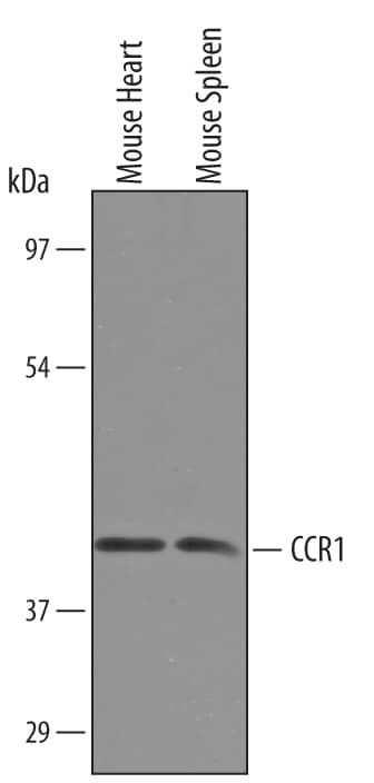 Detection of Mouse CCR1 antibody by Western Blot.