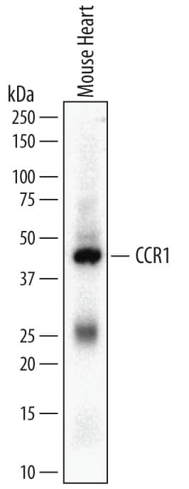 Detection of Mouse CCR1 antibody by Western Blot.