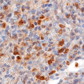 CCR2 antibody in Human Tonsil by Immunohistochemistry (IHC-P).