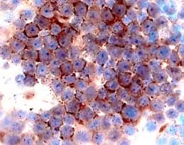 CCR3 antibody in Human Lymph Node by Immunohistochemistry (IHC-P).