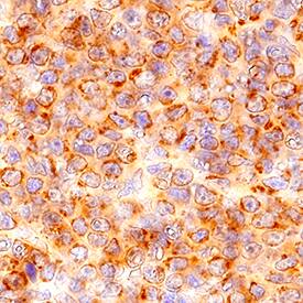 CCR6 antibody in Human Spleen by Immunohistochemistry (IHC-P).