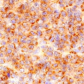 CCR6 antibody in Mouse Spleen by Immunohistochemistry (IHC-P).