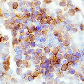 CCR6 antibody in Mouse Spleen by Immunohistochemistry (IHC-Fr).