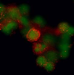CCR7 antibody in Human PBMCs by Immunocytochemistry (ICC).