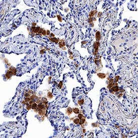 CCR7 antibody in Human Lung by Immunohistochemistry (IHC-P).