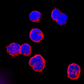 CCR9 antibody in MOLT-4 Human Cell Line by Immunocytochemistry (ICC).