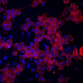 CCRL2/L-CCR/CRAM-A/B antibody in RAW 264 by Immunocytochemistry (ICC).7 Mouse Cell Line by Immunocytochemistry (ICC).