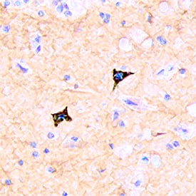 CD117/c-kit antibody in Human Brain by Immunohistochemistry (IHC-P).