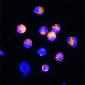 CD160 antibody in Mouse Splenocytes by Immunocytochemistry (ICC).