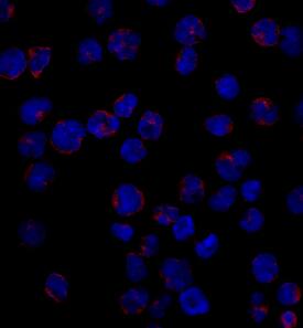 CD1a antibody in MOLT-4 Human Cell Line by Immunocytochemistry (ICC).