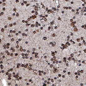 CD20 antibody in Human Leukemia by Immunohistochemistry (IHC-P).