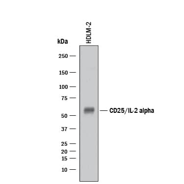 Detection of Human CD25/IL-2R alpha antibody by Western Blot.