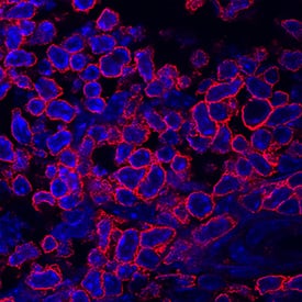 CD27/TNFRSF7 antibody in Mouse Splenocytes by Immunocytochemistry (ICC).