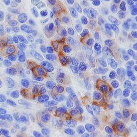 CD27/TNFRSF7 antibody in Human Tonsil by Immunohistochemistry (IHC-P).