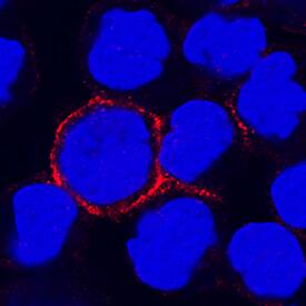 CD300f/LMIR3 antibody in Human PBMCs by Immunocytochemistry (ICC).