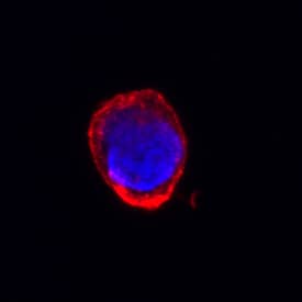 CD30/TNFRSF8 antibody in Jurkat Human Cell Line by Immunocytochemistry (ICC).