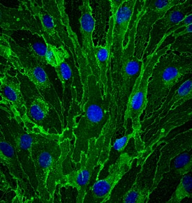CD31/PECAM-1 antibody in bEnd by Immunocytochemistry (ICC).3 Mouse Cell Line by Immunocytochemistry (ICC).