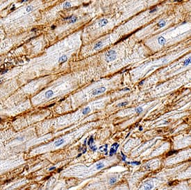CD36/SR-B3 antibody in Human Heart by Immunohistochemistry (IHC-P).