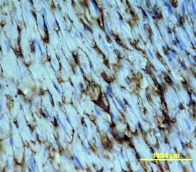 CD36/SR-B3 antibody in Mouse Heart by Immunohistochemistry (IHC-Fr).