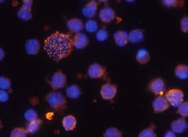 CD38 antibody in Human PBMCs by Immunocytochemistry (ICC).