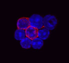CD3 antibody in Mouse Splenocytes by Immunocytochemistry (ICC).