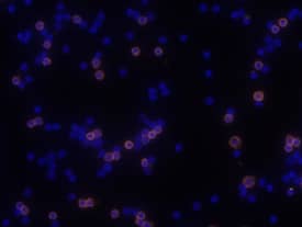 CD40/TNFRSF5 antibody in Mouse Splenocytes by Immunocytochemistry (ICC).