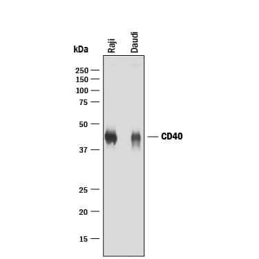 Detection of Human CD40/TNFRSF5 antibody by Western Blot.