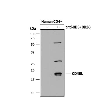 Detection of Human CD40 Ligand/TNFSF5 antibody by Western Blot.