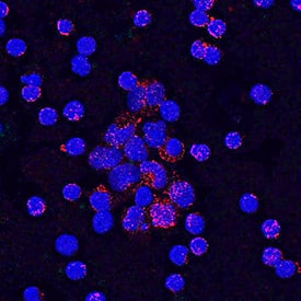 CD40/TNFRSF5 antibody in Human PBMCs by Immunocytochemistry (ICC).