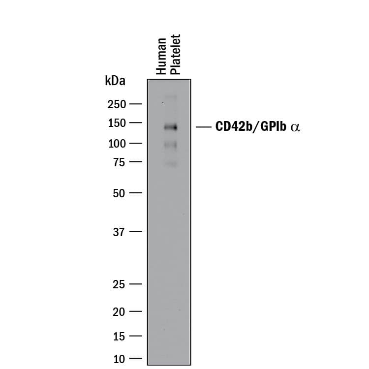 Detection of Human CD42b/GPIb a antibody by Western Blot.