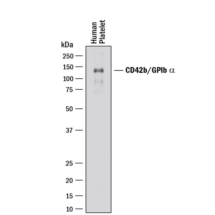 Detection of Human CD42b/GPIb a antibody by Western Blot.