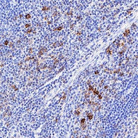 CD43 antibody in Human Tonsil by Immunohistochemistry (IHC-P).