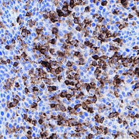 CD45 antibody in Human Tonsil by Immunohistochemistry (IHC-P).