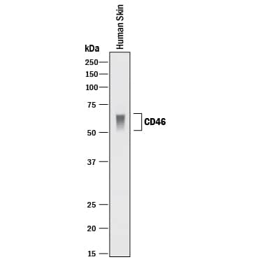 Detection of Human CD46 antibody by Western Blot.