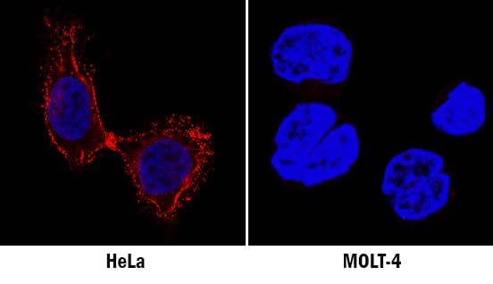 CD55/DAF antibody in HeLa and MOLT-4 Human Cell Lines by Immunocytochemistry (ICC).